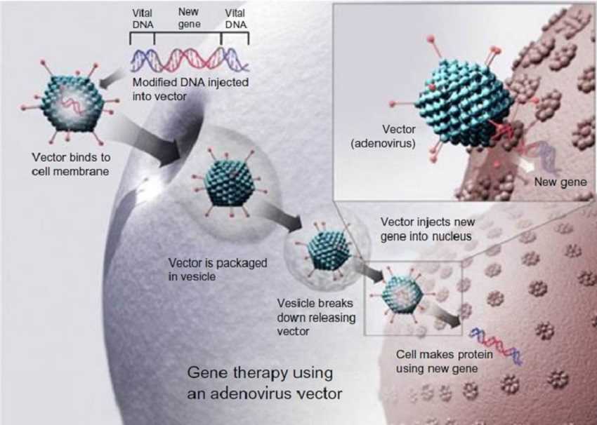 Gene therapy using an adenovirus vector.